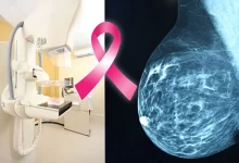 Dr Linda Smith, Breast Cancer Risk Assessment Farmington, Varicose Veins Santa Fe,